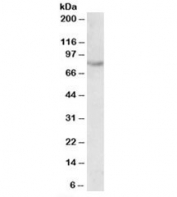 Western blot testing of fetal mouse kidney lysate with SIM2 antibody at 0.5ug/ml. Predicted molecular weight: 73kDa.