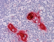 IHC testing of FFPE human thymus tissue with CXCR6 antibody at 3.75ug/ml. Required HIER: steamed antigen retrieval with pH6 citrate buffer; AP-staining.