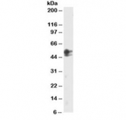Western blot testing of HeLa lysate with SMAD2 antibody at 2ug/ml. The 467 AA and 437 AA isoforms may be detected with this Ab.