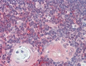 IHC testing of FFPE human thymus tissue with ARF4 antibody at 5ug/ml. Required HIER: steamed antigen retrieval with pH6 citrate buffer; AP-staining.