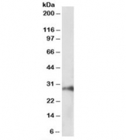 Western blot testing of pig kidney lysate with HOXA5 antibody at 1ug/ml. Predicted molecular weight: ~29 kDa.
