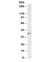 Western blot testing of pig bone marrow lysate with BMI1 antibody at 2ug/ml.