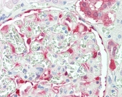 IHC testing of FFPE human kidney tissue with NQO1 antibody at 5ug/ml. Required HIER: steamed antigen retrieval with pH6 citrate buffer; AP-staining.