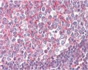 IHC testing of FFPE human tonsil tissue with SEPT2 antibody at 2.5ug/ml. Required HIER: steamed antigen retrieval with pH6 citrate buffer; AP-staining.