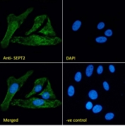 Immunofluorescent staining of fixed and permeabilized human U-2 OS cells with SEPT2 antibody (green) at 10ug/ml and DAPI nuclear stain (blue).