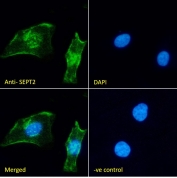 Immunofluorescent staining of fixed and permeabilized human HeLa cells with SEPT2 antibody (green) at 10ug/ml and DAPI nuclear stain (blue).