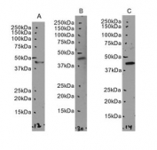 Western blot testing of A) human testis, B) mouse testis and C) rat testis tissue lysate with SEPT2 antibody. Predicted molecular weight: ~41 kDa.