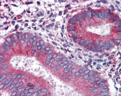 IHC staining of FFPE human uterus with Calnexin antibody at 3.8ug/ml. HIER: steamed with pH6 citrate buffer, AP-staining.