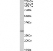 Western blot testing of human thyroid gland lysate with TSHR antibody at 0.1ug/ml. Predicted molecular weight: ~87 kDa (long) and ~28 kDa (short) forms.