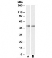 Western blot testing of mouse [A] and rat [B] brain lysates with GDE1 antibody at 0.3ug/ml. Predicted molecular weight: ~38/50kDa (unmodified/glycosylated).