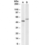 Western blot testing of human hippocampus [A] and HeLa [B] lysates with CD47 antibody at 0.3ug/ml. Predicted molecular weight: 35~60 kDa depending on glycosylation level.