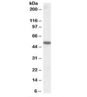 Western blot testing of human cerebral cortex lysate with 5HT3B receptor antibody at 1ug/ml. Predicted molecular weight (human): ~50kDa.