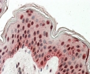 IHC staining of FFPE human skin with TIAR antibody at 4ug/ml. HIER: steamed with pH6 citrate buffer, AP-staining.