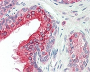 IHC testing of FFPE human prostate tissue with ANKK1 antibody at 5ug/ml. Required HIER: steamed antigen retrieval with pH6 citrate buffer; AP-staining.