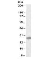 Western blot testing of human liver lysate with SIAH1 antibody at 1ug/ml. Predicted molecular weight: ~31kDa.