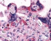 IHC testing of FFPE human placental tissue with BAG3 antibody at 3.75ug/ml. Required HIER: steamed antigen retrieval with pH6 citrate buffer; AP-staining.
