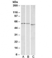 Western blot testing of A) human, B) mouse and C) rat heart lysate with ADRA1B antibody at 0.1ug/ml. Predicted molecular weight: ~57kDa.