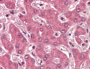 IHC testing of FFPE human liver tissue with APOB antibody at 2ug/ml. Required HIER: steamed antigen retrieval with pH6 citrate buffer; AP-staining.