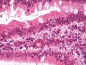 IHC testing of FFPE human small intestine tissue with APOB antibody at 2ug/ml. Required HIER: steamed antigen retrieval with pH6 citrate buffer; AP-staining.