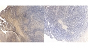 IHC staining of FFPE human tonsil tissue with CB2 antibody at 4ug/ml (left) and without primary antibody (right). Required HIER: steamed antigen retrieval with pH6 citrate buffer; HRP-staining.