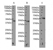 Western blot testing of human A) hippocampus, 2) cerebellum and 3) duodenum tissue lysate with CB2 antibody. Predicted molecular weight ~38 kDa.