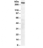 Western blot testing of mouse brain lysate with SORLA antibody at 0.3ug/ml. Predicted/observed molecular weight: ~250kDa.