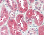 IHC testing of FFPE human kidney tissue with BDH2 antibody at 5ug/ml. Required HIER: steamed antigen retrieval with pH6 citrate buffer; AP-staining.