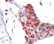 IHC testing of FFPE human testis with TIAM2 antibody at 5ug/ml. HIER: steamed with pH6 citrate buffer, AP-staining.