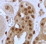 IHC testing of FFPE human kidney with Jagged 1 antibody at 2ug/ml. HIER: steamed with pH6 citrate buffer, HRP-staining.
