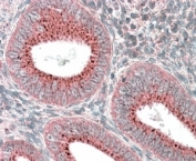 IHC staining of FFPE human uterus with SNX1 antibody. HIER: steamed with pH6 citrate buffer, AP-staining.