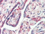 IHC testing of FFPE human placental tissue with PDLIM1 antibody at 0.5ug/ml. Steamed antigen retrieval with citrate buffer pH 6, AP-staining.