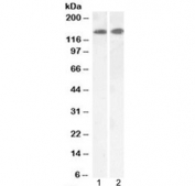 Western blot testing of 1) mouse brain and 2) rat brain lysate with Leptin Receptor antibody at 0.1ug/ml. Predicted molecular weight: ~ 125 kDa (long form), ~ 100 kDa (short form).