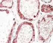 IHC staining of FFPE human thyroid gland with thyroid Peroxidase antibody at 5ug/ml. HIER: steamed with pH6 citrate buffer, AP-staining.