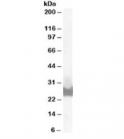 Western blot testing of A431 lysate with BID antibody at 0.1ug/ml. Predicted molecular weight ~26/22 kDa (isoforms 1/2)