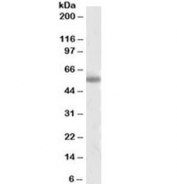 Western blot testing of human cerebral cortex lysate with Tyrosine Hydroxylase antibody at 2ug/ml. Predicted molecular weight 55~60 kDa.