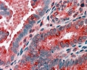 IHC staining of FFPE human uterus with ACTR1B antibody at 4ug/ml. HIER: steamed with pH6 citrate buffer, AP-staining.