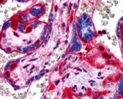 IHC staining of FFPE human placenta with Annexin A11 antibody at 4ug/ml. HIER: steamed with pH6 citrate buffer, AP-staining.