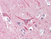 IHC testing of FFPE human brain (cortex) tissue with UBR2 antibody at 5ug/ml. HIER: steamed antigen retrieval with pH6 citrate buffer; AP-staining.