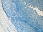 Negative control: IHC staining of FFPE human tonsil tissue without primary antibody. HIER: steamed with pH6 citrate buffer, HRP-staining.