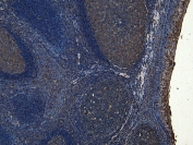 IHC staining of FFPE human tonsil tissue with SOX2 antibody at 8ug/ml. Required HIER: steamed antigen retrieval with pH6 citrate buffer; HRP-staining.