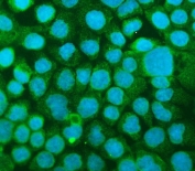 Immunofluorescent staining of FFPE human A431 cells with ICAM1 antibody (green) and DAPI nuclear stain (blue). HIER: steam section in pH6 citrate buffer for 20 min.