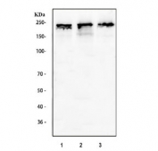 Western blot testing of human 1) HeLa, 2) 293T and 3) SH-SY5Y cell lysate with Dnmt1 antibody. Predicted molecular weight 180-200 kDa.