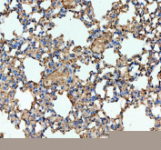 IHC staining of FFPE mouse lung tissue with Ace antibody. HIER: boil tissue sections in pH8 EDTA for 20 min and allow to cool before testing.