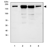 Western blot testing of 1) rat lung, 2) mouse lung, 3)  mouse kidney and 4) mouse heart tissue lysate with Ace antibody. Expected molecular weight 140-170 kDa.