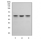 Western blot testing of human 1) MCF7, 2) HepG2 and 3) RT4 cell lysate with FOXA1 antibody at 0.5ug/ml. Predicted molecular weight ~49 kDa.