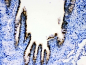 IHC testing of FFPE rat lung tissue with AGRP antibody at 1ug/ml. Required HIER: steam section in pH6 citrate buffer for 20 min and allow to cool prior to testing.
