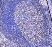 IHC testing of FFPE human tonsil tissue with CD11c antibody at 1ug/ml. Required HIER: steam section in pH6 citrate buffer for 20 min and allow to cool prior to testing.