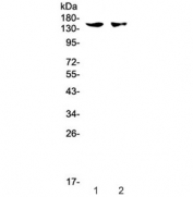 Western blot testing of 1) mouse spleen and 2) mouse thymus tissue with CD11c antibody at 0.5ug/ml. Expected molecular weight: 128-150 kDa.