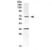 Western blot testing of mouse HEPA1-6 cell lysate with Alpha 1 Fetoprotein antibody at 0.5ug/ml. Predicted molecular weight ~67 kDa.