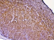 IHC testing of FFPE rat lymph tissue with Ptpn22 antibody at 1ug/ml. Required HIER: steam section in pH6 citrate buffer for 20 min and allow to cool prior to testing.
